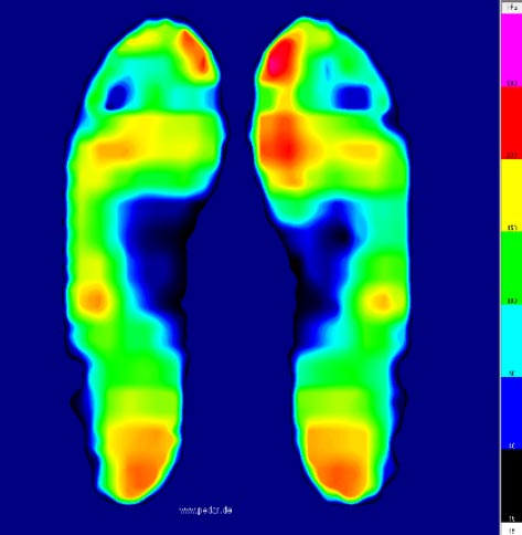 比較対照条件の足圧分布